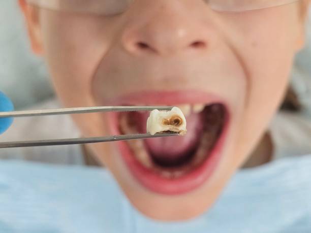 Best Urgent Dental Care for Toothaches in Fort Riley, KS